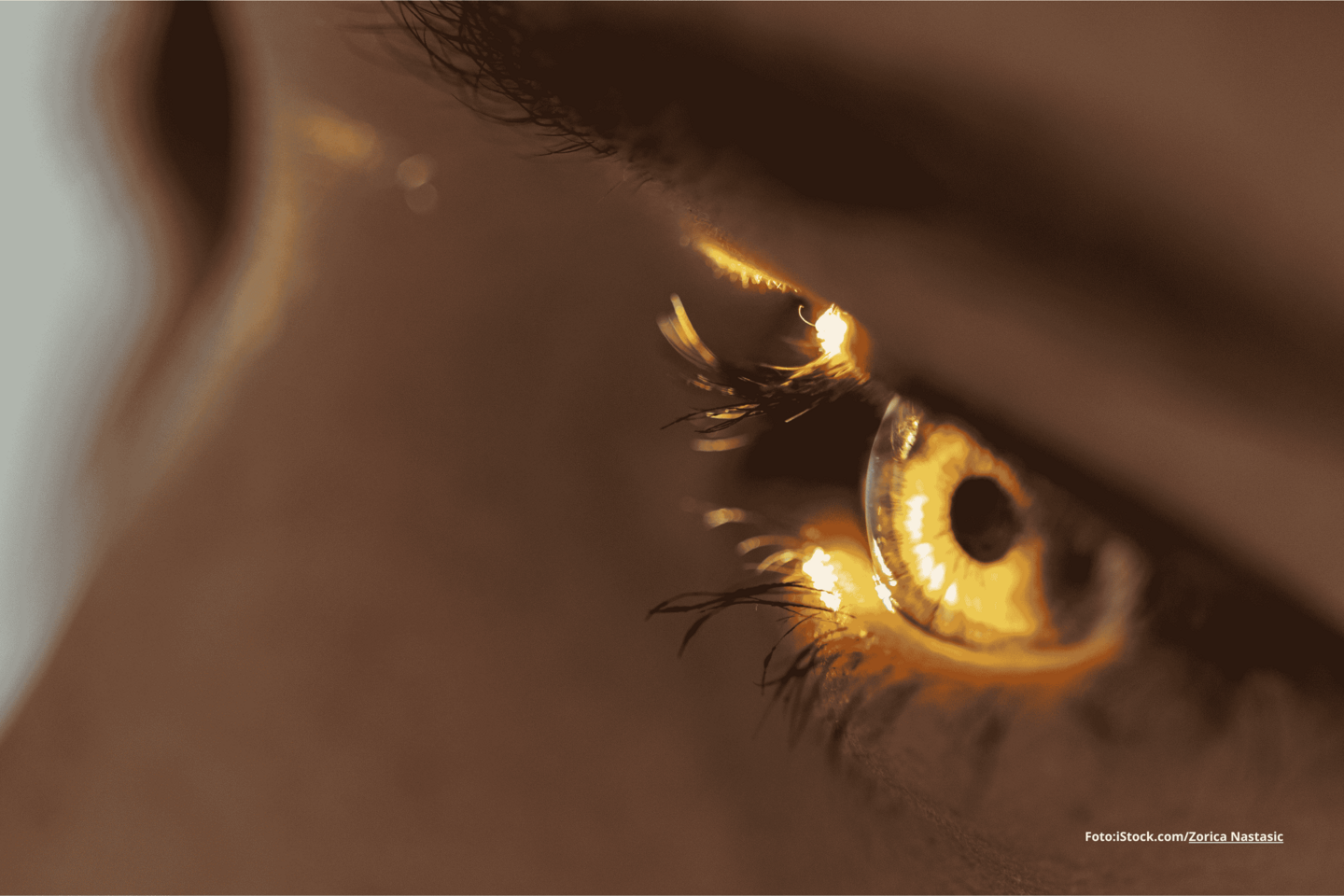 Das Foto zeigt ein Auge in Nahaufnahme bei der Augenuntersuchung mit Licht.