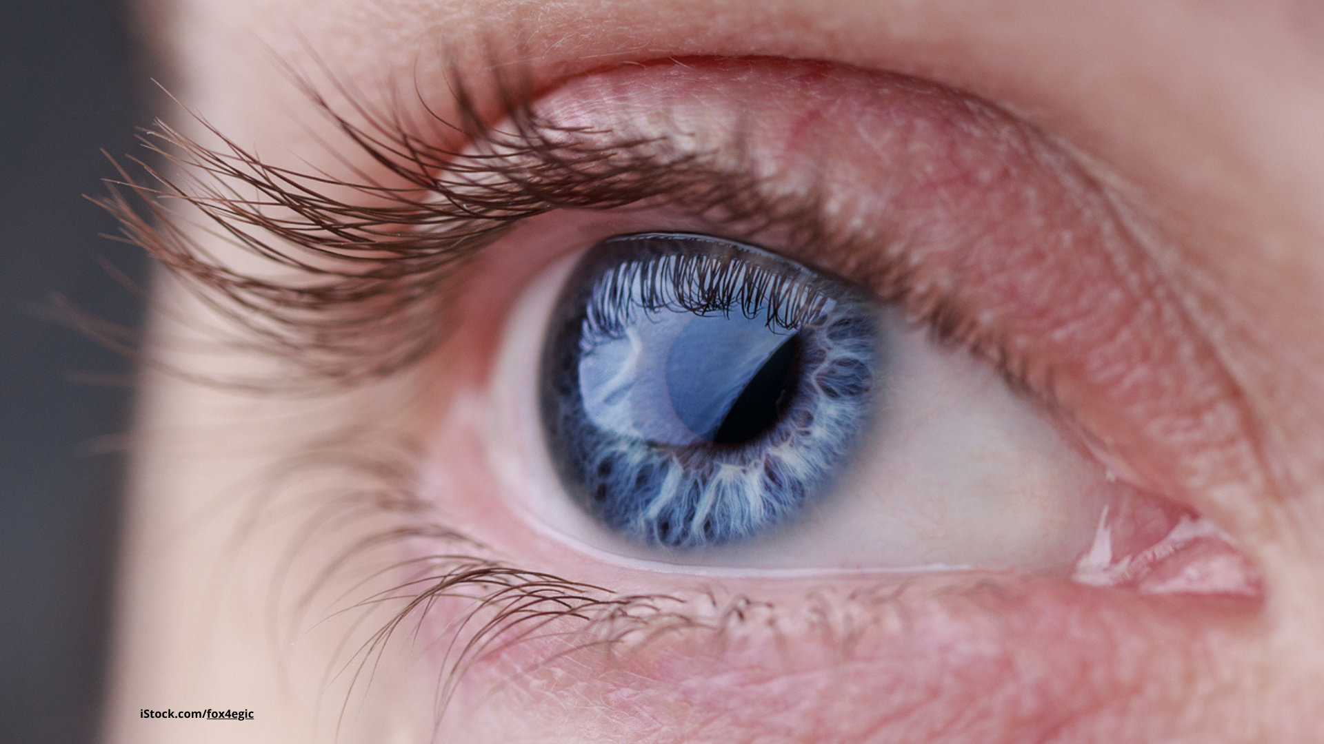 Das Bild zeigt ein blaues Auge in Nahaufnahme.
